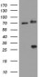 RIPK1 / RIP Antibody (clone 2G3)